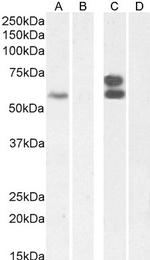 IKZF4 Antibody in Western Blot (WB)