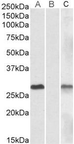 DYDC1 Antibody in Western Blot (WB)