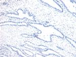 HOXD13 Antibody in Immunohistochemistry (Paraffin) (IHC (P))