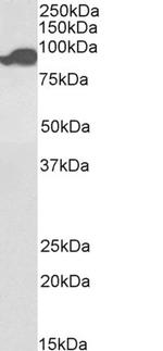 Aconitase 2 Antibody in Western Blot (WB)