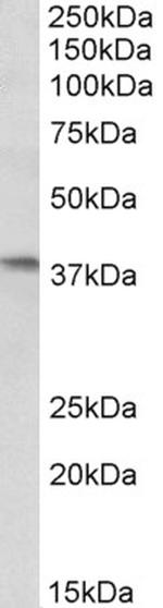 AIM2 Antibody in Western Blot (WB)