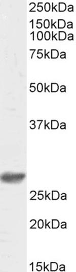 DCUN1D1 Antibody in Western Blot (WB)