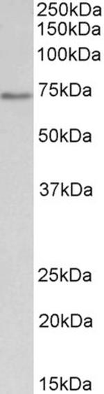 CDC6 Antibody in Western Blot (WB)