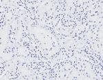 NIPBL Antibody in Immunohistochemistry (Paraffin) (IHC (P))