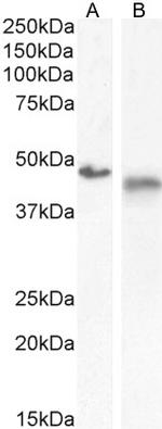 IL1R2 Antibody in Western Blot (WB)