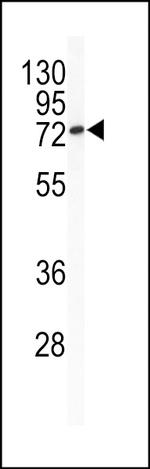 BCL6 Antibody in Western Blot (WB)