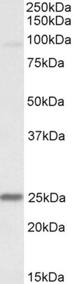 NDUFS8 Antibody in Western Blot (WB)