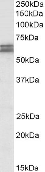 CADM1 Antibody in Western Blot (WB)