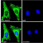 Angiopoietin 1 Antibody in Immunocytochemistry (ICC/IF)