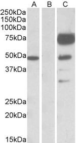 Angiopoietin 1 Antibody in Western Blot (WB)