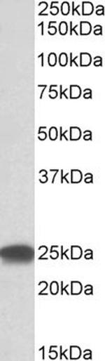 PSMB4 Antibody in Western Blot (WB)