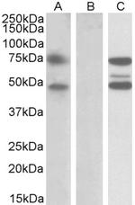 ASNSD1 Antibody in Western Blot (WB)