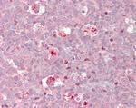 cIAP2 Antibody in Immunohistochemistry (Paraffin) (IHC (P))