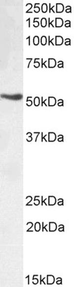 TRIM72 Antibody in Western Blot (WB)