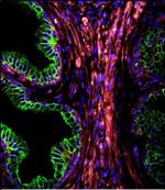 Cytokeratin 18 Antibody in Immunocytochemistry (ICC/IF)