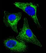 Cytokeratin 18 Antibody in Immunocytochemistry (ICC/IF)