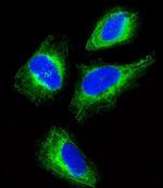 Cytokeratin 18 Antibody in Immunocytochemistry (ICC/IF)