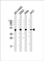 Cytokeratin 18 Antibody in Western Blot (WB)