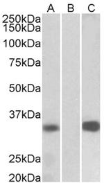 KChIP3 Antibody in Western Blot (WB)