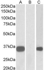 KChIP3 Antibody in Western Blot (WB)