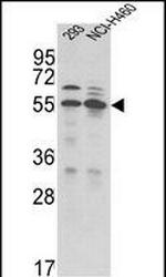 TMPRSS2 Antibody in Western Blot (WB)