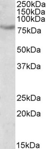 SIM2 Antibody in Western Blot (WB)