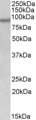 NPAS4 Antibody in Western Blot (WB)