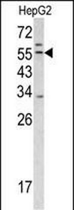 TMPRSS2 Antibody in Western Blot (WB)