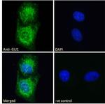 GLI1 Antibody in Immunocytochemistry (ICC/IF)