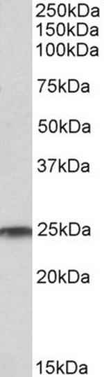 RAN Antibody in Western Blot (WB)