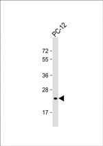 DHFR Antibody in Western Blot (WB)