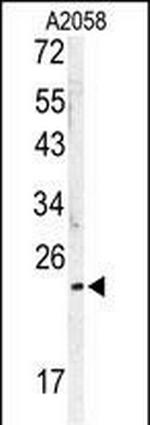 MOB1 Antibody in Western Blot (WB)