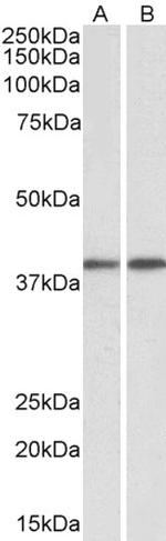 GNAQ Antibody in Western Blot (WB)