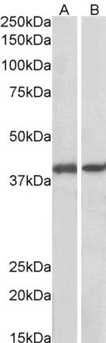 GNAQ Antibody in Western Blot (WB)