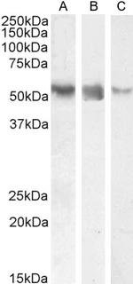 ROR gamma Antibody in Western Blot (WB)