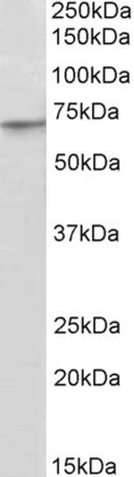 PRDM14 Antibody in Western Blot (WB)