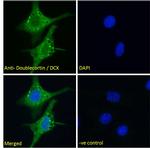 Doublecortin Antibody in Immunocytochemistry (ICC/IF)