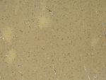 Doublecortin Antibody in Immunohistochemistry (Paraffin) (IHC (P))