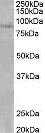 SETDB2 Antibody in Western Blot (WB)