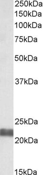 NCE2 Antibody in Western Blot (WB)