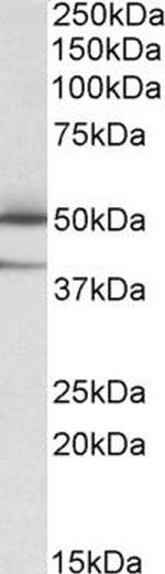 TXNDC5 Antibody in Western Blot (WB)