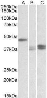 TXNDC5 Antibody in Western Blot (WB)