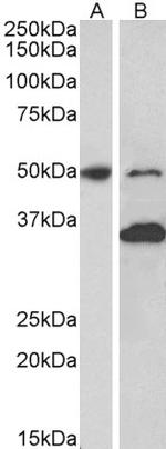 MKRN1 Antibody in Western Blot (WB)