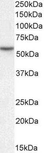 MKRN1 Antibody in Western Blot (WB)