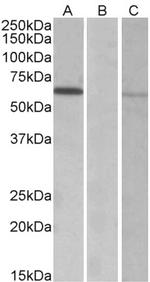 MKRN1 Antibody in Western Blot (WB)