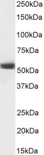 MKRN1 Antibody in Western Blot (WB)