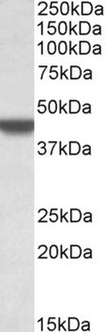 APOBEC3D Antibody in Western Blot (WB)