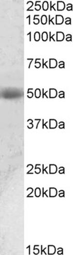 Prostate Specific Acid Phosphatase Antibody in Western Blot (WB)