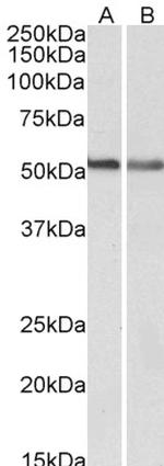 Cannabinoid Receptor 1 Antibody in Western Blot (WB)