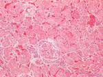 SOD2 (MnSOD) Antibody in Immunohistochemistry (Paraffin) (IHC (P))